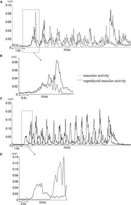 Differentiation of Feeding Behaviors Based on Masseter and Supra-Hyoid Muscle Activity